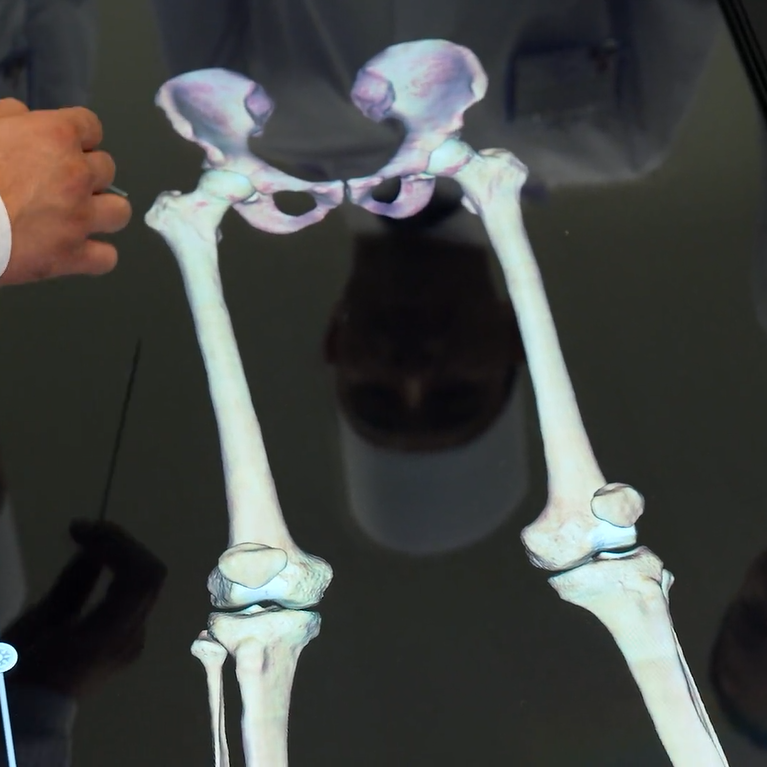 A&yacute;agyň skeletiniň s&uuml;ňkleri. &Ccedil;anaklyk s&uuml;ňki. Anatomage 3D enjamynda amaly sapak.